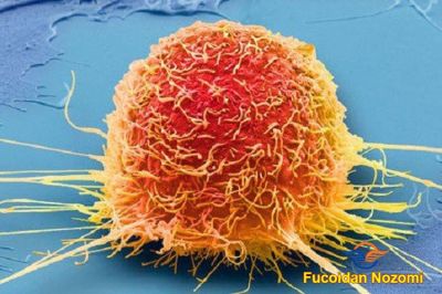 Tế bào ung thư sợ gì nhất