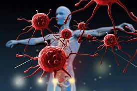 4 loại ung thư thường gặp ở phụ nữ và cách phát hiện sớm